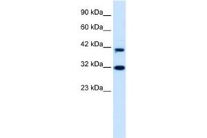 WB Suggested Anti-DPF1 Antibody Titration:  0.