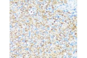 Immunohistochemistry of paraffin-embedded Rat ovary using NMT1 Polyclonal Antibody at dilution of 1:100 (40x lens). (NMT1 Antikörper)