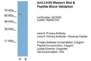 Host:  Rabbit  Target Name:  LHX6  Sample Type:  HepG2  Lane A:  Primary Antibody  Lane B:  Primary Antibody + Blocking Peptide  Primary Antibody Concentration:  2.