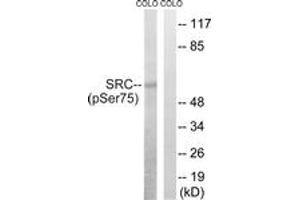 Western blot analysis of extracts from COLO205 cells treated with EGF 200ng/ml 30', using Src (Phospho-Ser75) Antibody. (Src Antikörper  (pSer75))