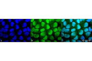 Immunocytochemistry/Immunofluorescence analysis using Rabbit Anti-Methylated Lysine Polyclonal Antibody . (Lysine (lys) (methylated) Antikörper (HRP))