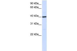 WB Suggested Anti-MOSC1 Antibody Titration:  0. (MOSC1 Antikörper  (C-Term))