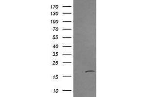 Image no. 2 for anti-Cancer/testis Antigen 1B (CTAG1B) antibody (ABIN1499893) (CTAG1B Antikörper)