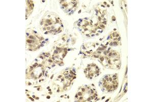 Immunohistochemistry of paraffin-embedded human breast using PRPF3 Antibody (ABIN5973192) at dilution of 1/100 (40x lens). (PRPF3 Antikörper)