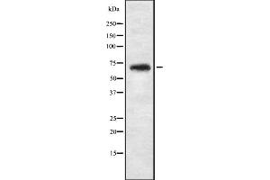 Western blot analysis of NBPF4 expression in 293T whole cell lysate ,The lane on the left is treated with the antigen-specific peptide. (NBPF4 Antikörper)