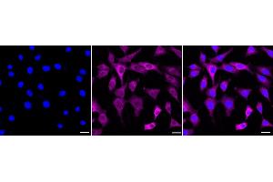 Immunocytochemical staining of C2C12 cells with Phospho-MEK1 (S298) antibody (ABIN7799462), 1:1,000). (Rekombinanter MEK1 Antikörper  (pSer298))