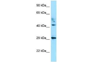 Western Blotting (WB) image for anti-Ataxia, Cerebellar, Cayman Type (ATCAY) (C-Term) antibody (ABIN2788612)