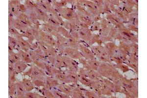 IHC image of ABIN7142862 diluted at 1:400 and staining in paraffin-embedded human heart tissue performed on a Leica BondTM system. (INPP5E Antikörper  (AA 1-133))