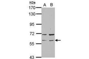 Image no. 2 for anti-RAP1, GTP-GDP Dissociation Stimulator 1 (RAP1GDS1) (N-Term) antibody (ABIN1494067) (RAP1GDS1 Antikörper  (N-Term))