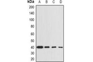 Western blot analysis of GNA13 expression in BT474 (A), THP1 (B), mouse lung (C), mouse spleen (D) whole cell lysates. (GNA13 Antikörper)