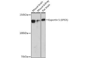 Western blot analysis of extracts of various cell lines, using Exportin 5 (XPO5) (XPO5) Rabbit mAb (ABIN1682763, ABIN3018126, ABIN3018127 and ABIN7101577) at 1:1000 dilution. (XPO5 Antikörper)