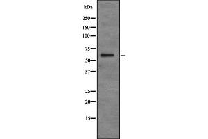 Western blot analysis of PDP2 expression in Jurkat cell lysate,The lane on the left is treated with the antigen-specific peptide. (PDP2 Antikörper  (N-Term))