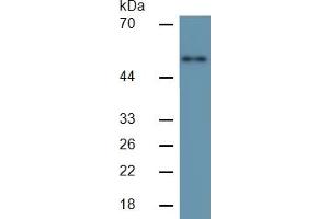 Mouse Capture antibody from the kit in WB with Positive Control: Human SGC7901 cell lsate.