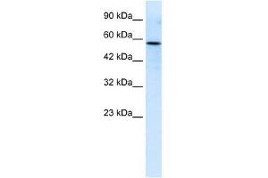Human Jurkat; WB Suggested Anti-RIPX Antibody Titration: 0. (RUFY3 Antikörper  (C-Term))