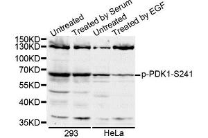 Western blot analysis of extracts of various cell lines, using Phospho-PDK1-S241 antibody. (PDPK1 Antikörper  (pSer241))
