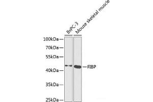 Western blot analysis of extracts of various cell lines using FIBP Polyclonal Antibody at dilution of 1:1000. (FIBP Antikörper)