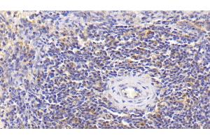 Detection of IL18 in Human Spleen Tissue using Monoclonal Antibody to Interleukin 18 (IL18) (IL-18 Antikörper  (AA 94-193))