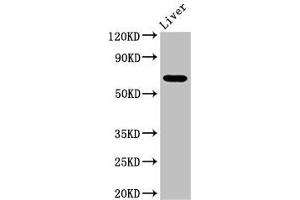 Western Blot Positive WB detected in: Mouse liver tissue All lanes: SENP2 antibody at 3. (SENP2 Antikörper  (AA 138-324))