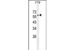 ZN Antibody (C-term) (ABIN654976 and ABIN2844616) western blot analysis in Y79 cell line lysates (35 μg/lane). (ZNF678 Antikörper  (C-Term))