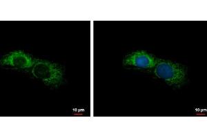 ICC/IF Image ALDH7A1 antibody detects ALDH7A1 protein at mitochondria by immunofluorescent analysis. (ALDH7A1 Antikörper)