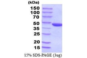 PGK2 Protein (AA 1-417) (His tag)