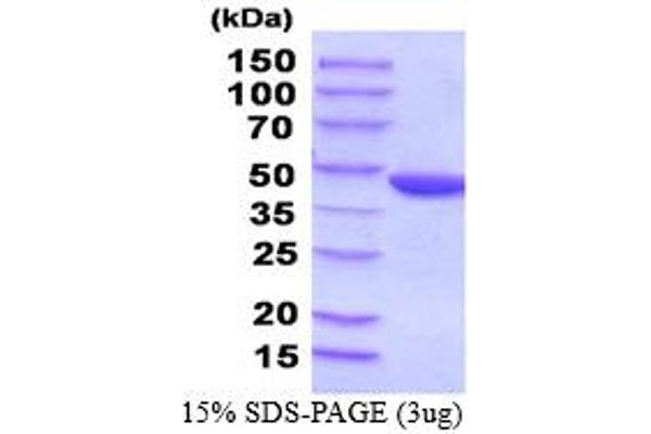 PGK2 Protein (AA 1-417) (His tag)