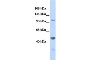Western Blotting (WB) image for anti-Potassium Large Conductance Calcium-Activated Channel, Subfamily M, alpha Member 1 (KCNMA1) (C-Term) antibody (ABIN2776143)
