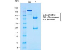 SDS-PAGE Analysis of Purified Chromogranin A Rabbit Recombinant Monoclonal Antib (CHGA/1731R). (Rekombinanter Chromogranin A Antikörper)