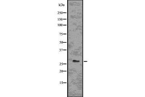 Western blot analysis of BCL2A1 using Jurkat whole  lysates. (BCL2A1 Antikörper  (Internal Region))