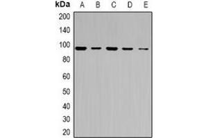 Western blot analysis of ABCF1 expression in HeLa (A), COLO205 (B), HCT116 (C), mouse testis (D), rat testis (E) whole cell lysates. (ABCF1 Antikörper  (C-Term))