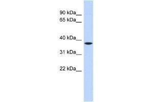 C22ORF30 antibody used at 1 ug/ml to detect target protein. (C22ORF30 Antikörper  (Middle Region))