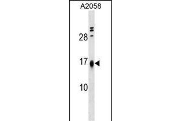 LBH Antikörper  (AA 26-53)