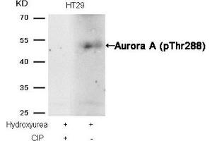 Western blot analysis of extracts from HT29 cells, treated with Hydroxyurea or calf intestinal phosphatase (CIP), using Aurora A (phospho-Thr288) Antibody. (Aurora A Antikörper  (pThr288))