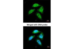 ICC/IF Image Immunofluorescence analysis of paraformaldehyde-fixed HeLa, using CtBP1, antibody at 1:200 dilution. (CTBP1 Antikörper  (Center))