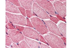 Anti-AES antibody IHC of human skeletal muscle. (AES Antikörper  (C-Term))