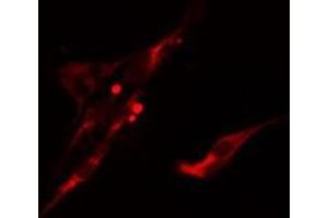 ABIN6275614 staining  LOVO cells by IF/ICC. (UBASH3A Antikörper  (Internal Region))