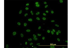 Immunofluorescence of monoclonal antibody to SURB7 on HeLa cell. (MED21 Antikörper  (AA 1-144))