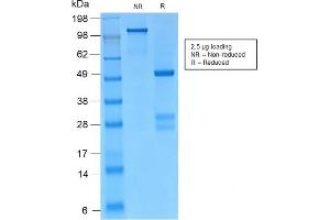 SDS-PAGE Analysis Purified Catenin, gamma Rabbit Monoclonal Antibody (CTNG/2155R). (Rekombinanter JUP Antikörper)