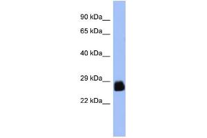 WB Suggested Anti-PDX1 Antibody Titration:  0. (PDX1 Antikörper  (N-Term))