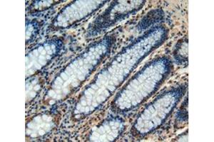 IHC-P analysis of Human Rectum Tissue, with DAB staining. (CHI3L1 Antikörper  (AA 112-377))