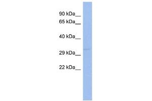WB Suggested Anti-SIX1 Antibody Titration:  0. (SIX Homeobox 1 Antikörper  (Middle Region))