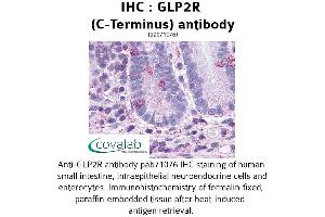 Image no. 1 for anti-Glucagon-Like Peptide 2 Receptor (GLP2R) (C-Term) antibody (ABIN1734731) (GLP2R Antikörper  (C-Term))