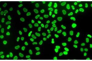 Immunofluorescence analysis of U2OS cells using TMPO Polyclonal Antibody (Thymopoietin Antikörper)