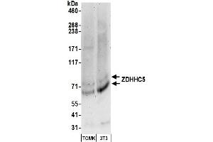 Western Blotting (WB) image for anti-Zinc Finger, DHHC-Type Containing 5 (ZDHHC5) (AA 500-550) antibody (ABIN7450931)
