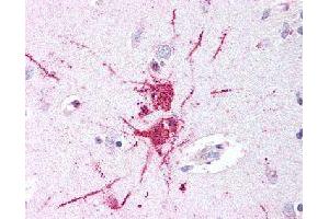 Immunohistochemical (Formalin/PFA-fixed paraffin-embedded sections) staining in human putamen (neurons and glia) with GPR52 polyclonal antibody . (GPR52 Antikörper)