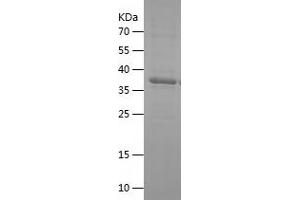 Western Blotting (WB) image for Decorin (DCN) (AA 36-195) protein (His-IF2DI Tag) (ABIN7122609)
