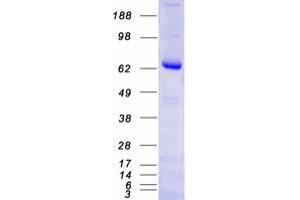 Western Blotting (WB) image for Poly (ADP-Ribose) Polymerase Family, Member 3 (PARP3) (Transcript Variant 2) protein (Myc-DYKDDDDK Tag) (ABIN2728269)