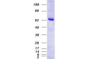 Validation with Western Blot (PARP3 Protein (Transcript Variant 2) (Myc-DYKDDDDK Tag))