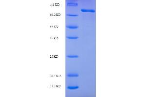 SDS-PAGE (SDS) image for Mannose Receptor, C Type 1 (MRC1) (AA 655-1213) protein (His-SUMO Tag) (ABIN4975549) (Macrophage Mannose Receptor 1 Protein (AA 655-1213) (His-SUMO Tag))