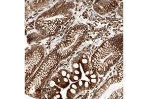 Immunohistochemical staining of human stomach with TAPBP polyclonal antibody  shows strong cytoplasmic and membranous positivity in glandular cells at 1:20-1:50 dilution. (TAPBP Antikörper)